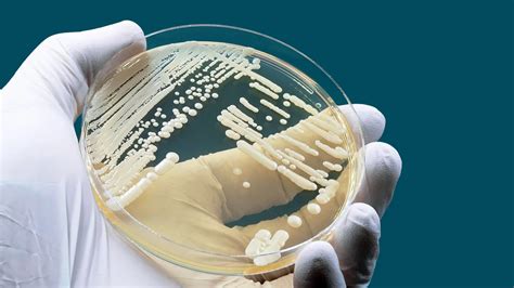 Blastomycosis: Understanding This Fungal Infection