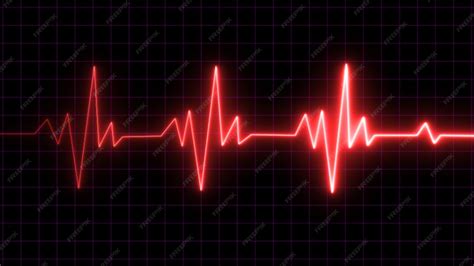 The heartbeat electrocardiogram ekg monitoring in an emergency ...