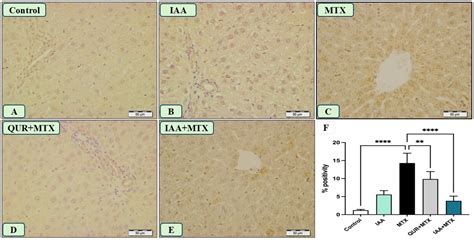 Indole-3-Acetic Acid: Promising Protective Agent Against Methotrexate ...