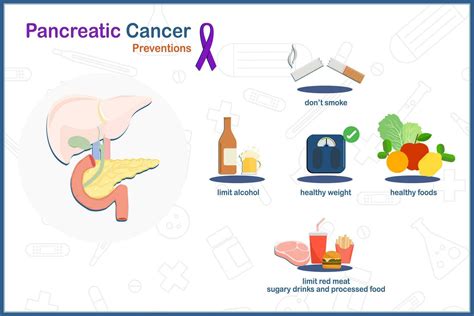 What Prevents Pancreatic Cancer