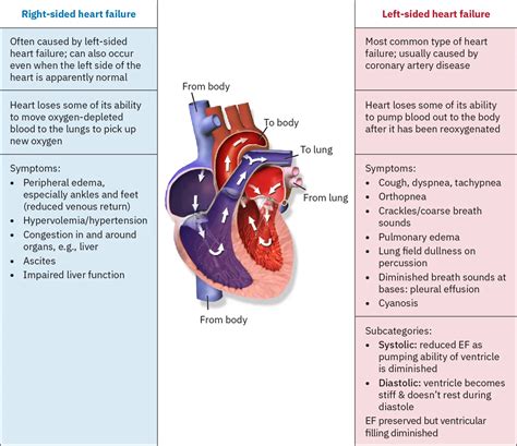 Right Vs Left Heart Failure