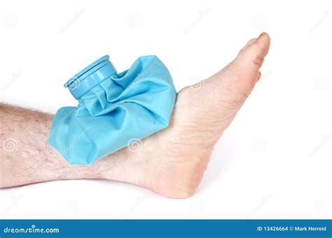Sprained Ankle With Bruise Adn Swelling, Female Foots. Ankle Injury Stock Image | CartoonDealer ...