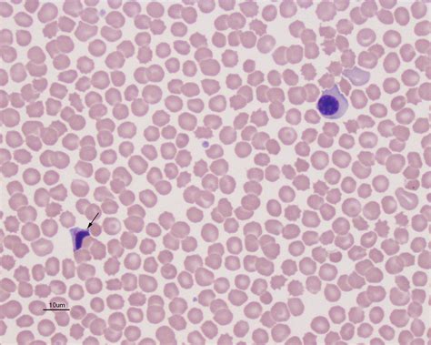 Nucleated Red Blood Cells