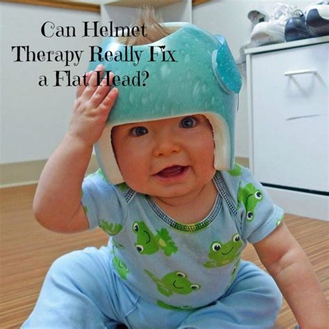 Cranial Helmet Therapy for Babies: Can It Really Fix a Flat Head? - HealthProAdvice