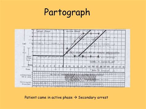 Image result for Partogram Examples