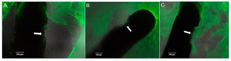 Effects of Microstructured and Anti-Inflammatory-Coated Cochlear ...
