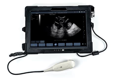 ScanX - Portable Ultrasound Machines