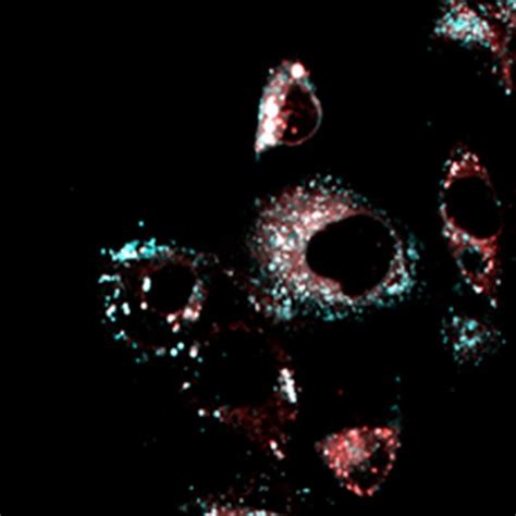 BioTracker™ LD-1 Near-IR Lipid Droplet Live Cell Probe | SCT241