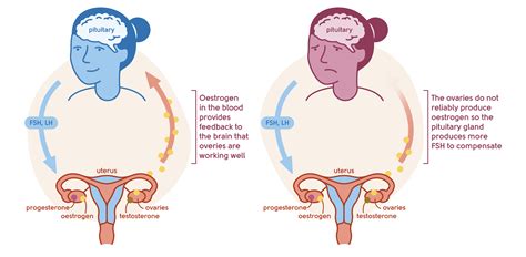 Menopause Symptoms | Headaches & Migraines | My Menopause Centre