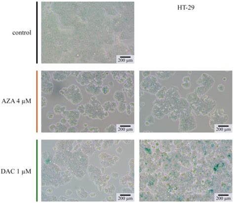 Cancers | Special Issue : Drug Repurposing for Cancer Therapy