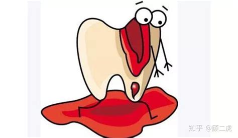 牙龈容易出血是什么原因引起的-牙龈容易出血是什么原因引起的,牙龈,容易,出血,是,什么,原因,引起 - 早旭经验网