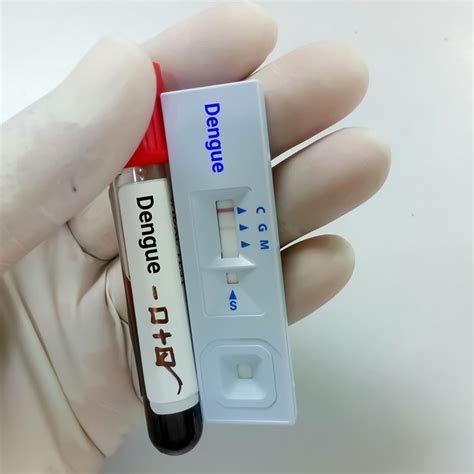 डेंगू कितने दिन रहता है, क्‍या यह संक्रामक है और कितना होता है नॉर्मल ...