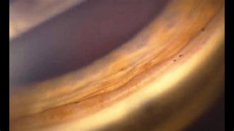 Angle Recession 的图像结果