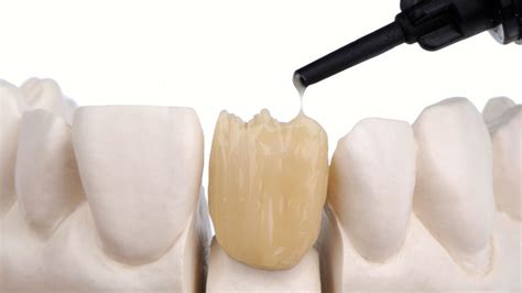 Umsteigen leicht gemacht | Quintessenz Verlags-GmbH