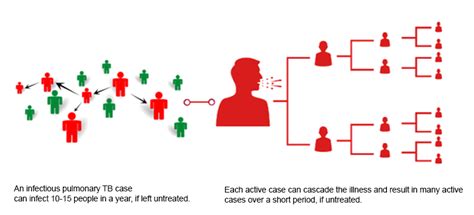 Exposure to Tuberculosis Bacilli and risk of infection | Knowledge Base