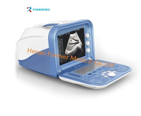 Ultrasound Scanner Machine 的图像结果