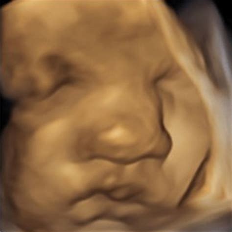 A case report and literature review: Obstetrics and neonatal outcomes ...