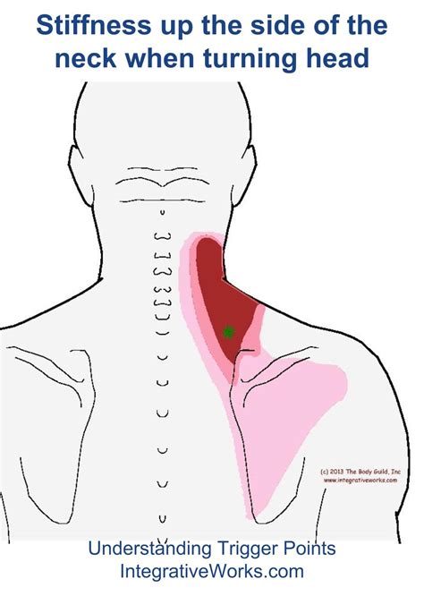 fi-stiff-up-the-side-of-the-neck-when-turning | Stiff neck remedies, Stiff neck relief, Trigger ...