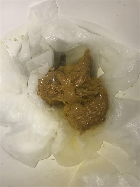 Oily Stool Photos