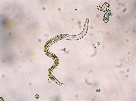 Signs, Symptoms, and Side Effects of Parasites | The NHCAA
