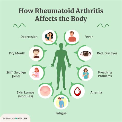 10 things i wish i knew 10 years ago about rheumatoid arthritis – Artofit
