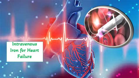 Ferric carboxymaltose not better than placebo for ambulatory heart ...