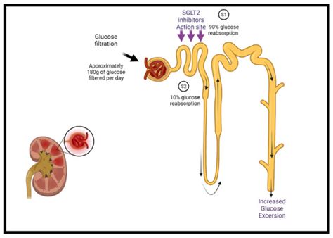 Contemporary Pillars of Heart Failure with Reduced Ejection Fraction ...