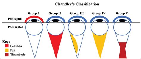 Orbital Cellulitis Stages