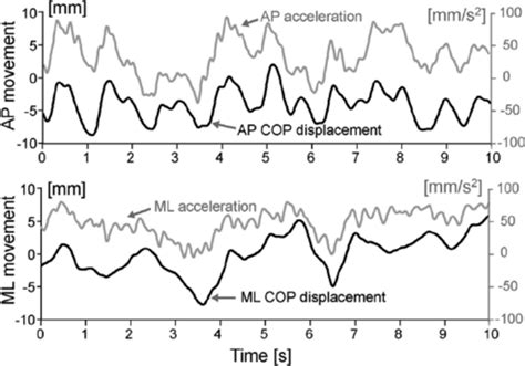 Image result for Rate Coding Sound Definition