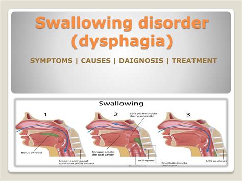 PPT - Swallowing disorder (dysphagia) in children- Causes, Symptoms ...
