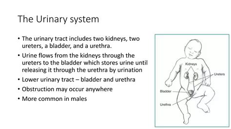 Bladder outlet obstruction in children | PPTX