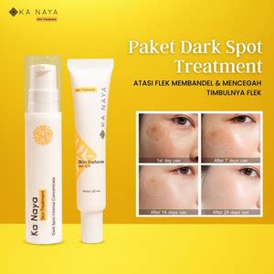 Promo Ka Naya Paket Flek Hitam | Cream Flek Hitam | Salep Flek Hitam ...