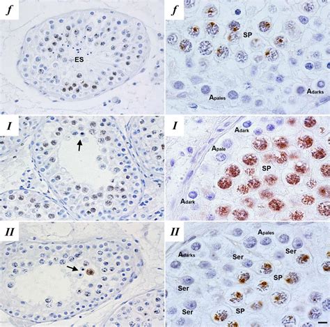 Meiosis Stages Under Microscope
