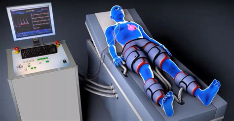 Non-Invasive EECP Heart Treatment | Renew Medical Center