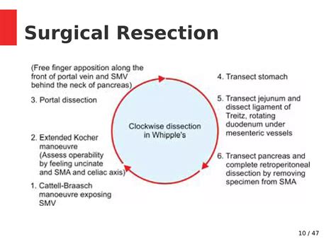 Whipple's procedure - Indications, Steps, Complications | PDF