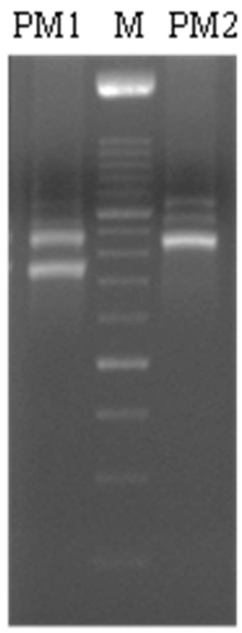 Biofilm Formation and Immunomodulatory Activity of Proteus mirabilis ...