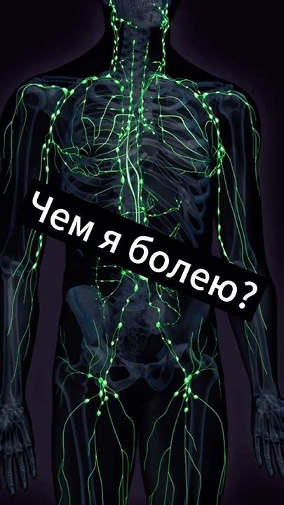 -🤒Чем я болею?.. или что такое Лимфома простыми словами📌 - YouTube