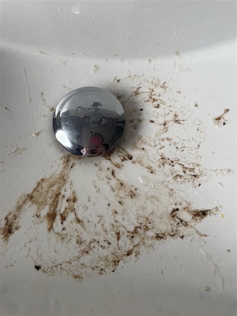 Is this coffee grounds vomit? : r/medical