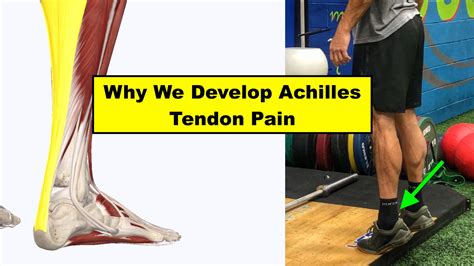 Achilles Tendon Pain When Climbing Stairs at Phyllis Bolick blog