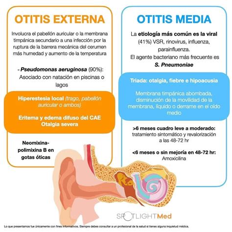 Otitis Interna