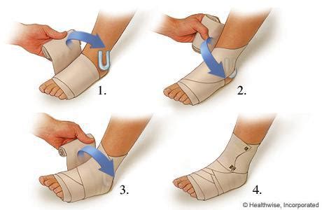 Applying a Compression Wrap for a Sprained Ankle | Absolute Foot and ...