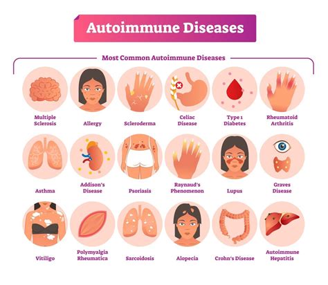 Crohn's Disease And Other Autoimmune Diseases at Monica Drolet blog