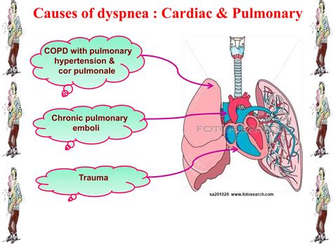 Dyspnea : for Nursing | PPTX