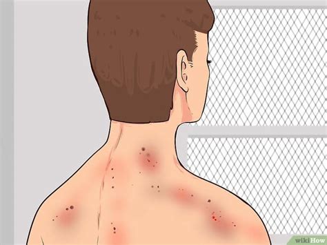 Radiation sickness : रेडिएशन सिकनेस क्या है? जानिए कारण, लक्षण और उपाय ...