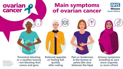 Ovarian Cancer Symptoms How To Remember The Symptoms Of Ovarian Cancer