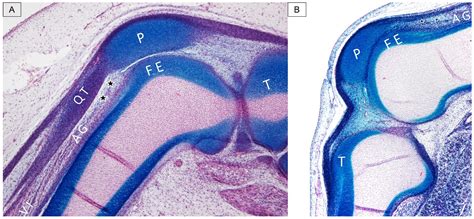 Ultrasound Imaging of the Articularis Genus Muscle: Implications for Ultrasound-Guided ...