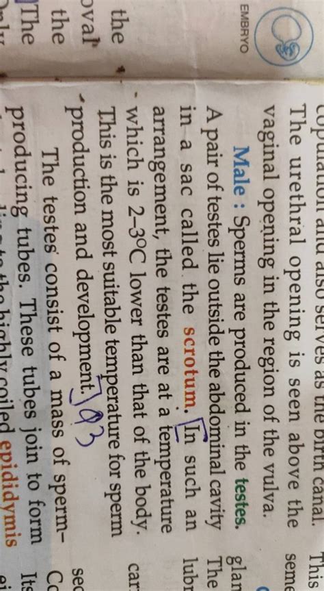 The urethral opening is seen above the sem vaginal opening in the region