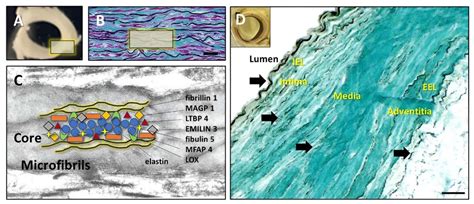 Binding of Pentagalloyl Glucose to Aortic Wall Proteins: Insights from ...