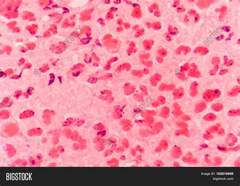 Gram Negative Diplococci Image & Photo | Bigstock