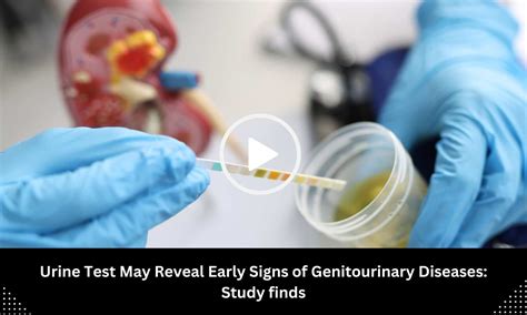 Urine Test May Reveal Early Signs of Genitourinary Diseases: Study finds